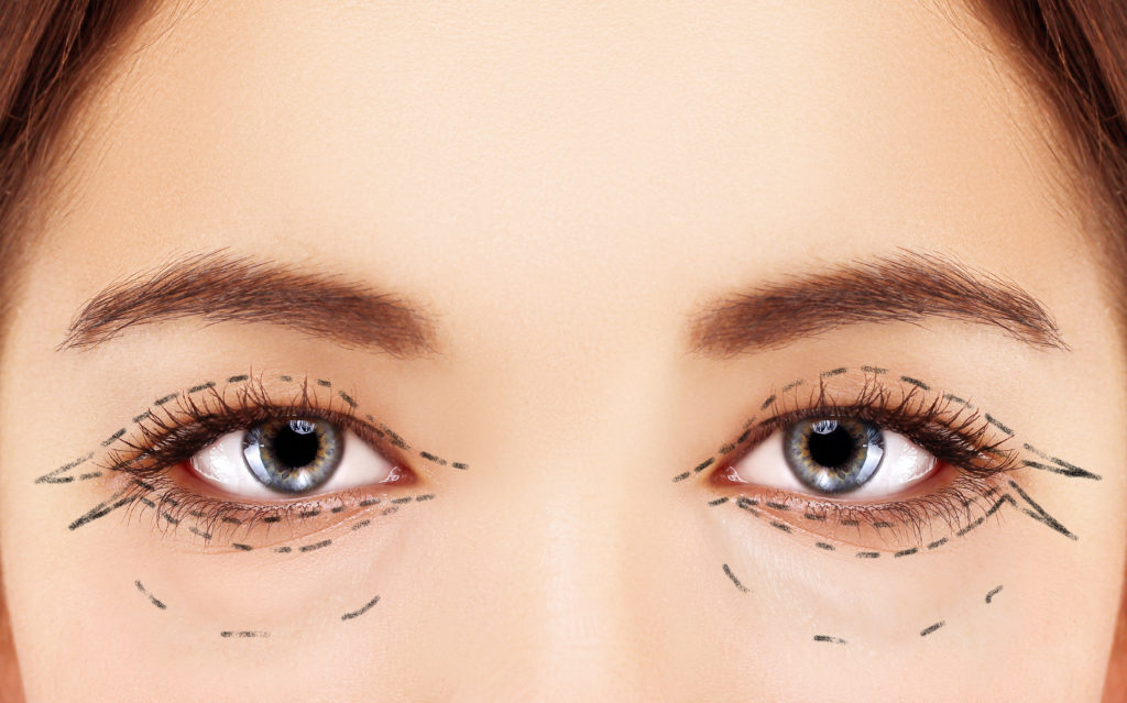 Tips For Successful Recovery After Eyelid Surgery